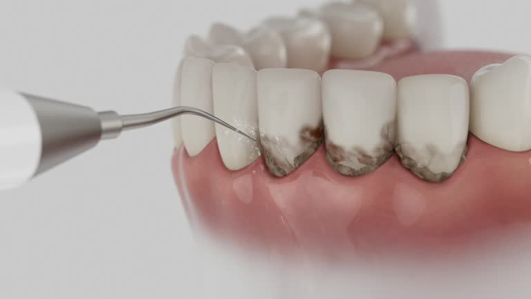 Trusted Tooth Extraction service in Moreland Hills, OH - Dentist Open Now